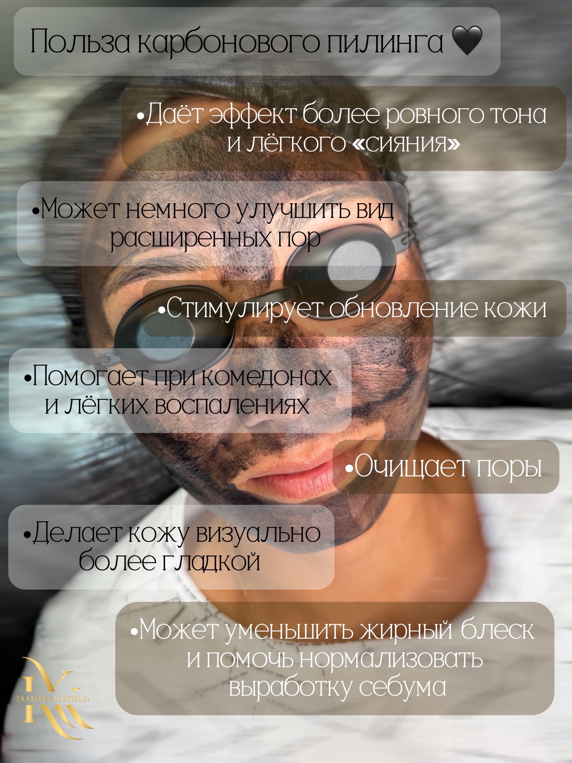 Карбоновый пилинг